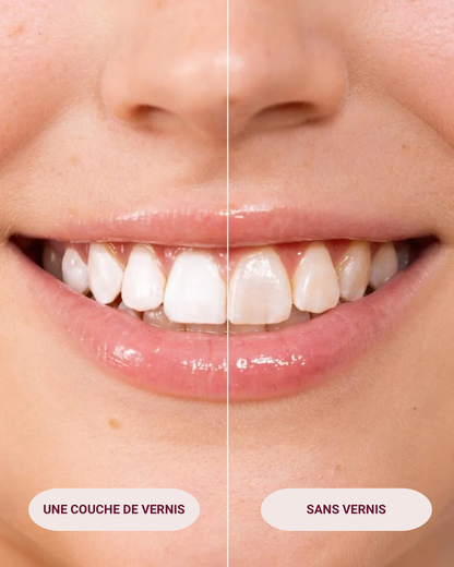 RUSH Vernis Dentaire - Dents instantanément blanches